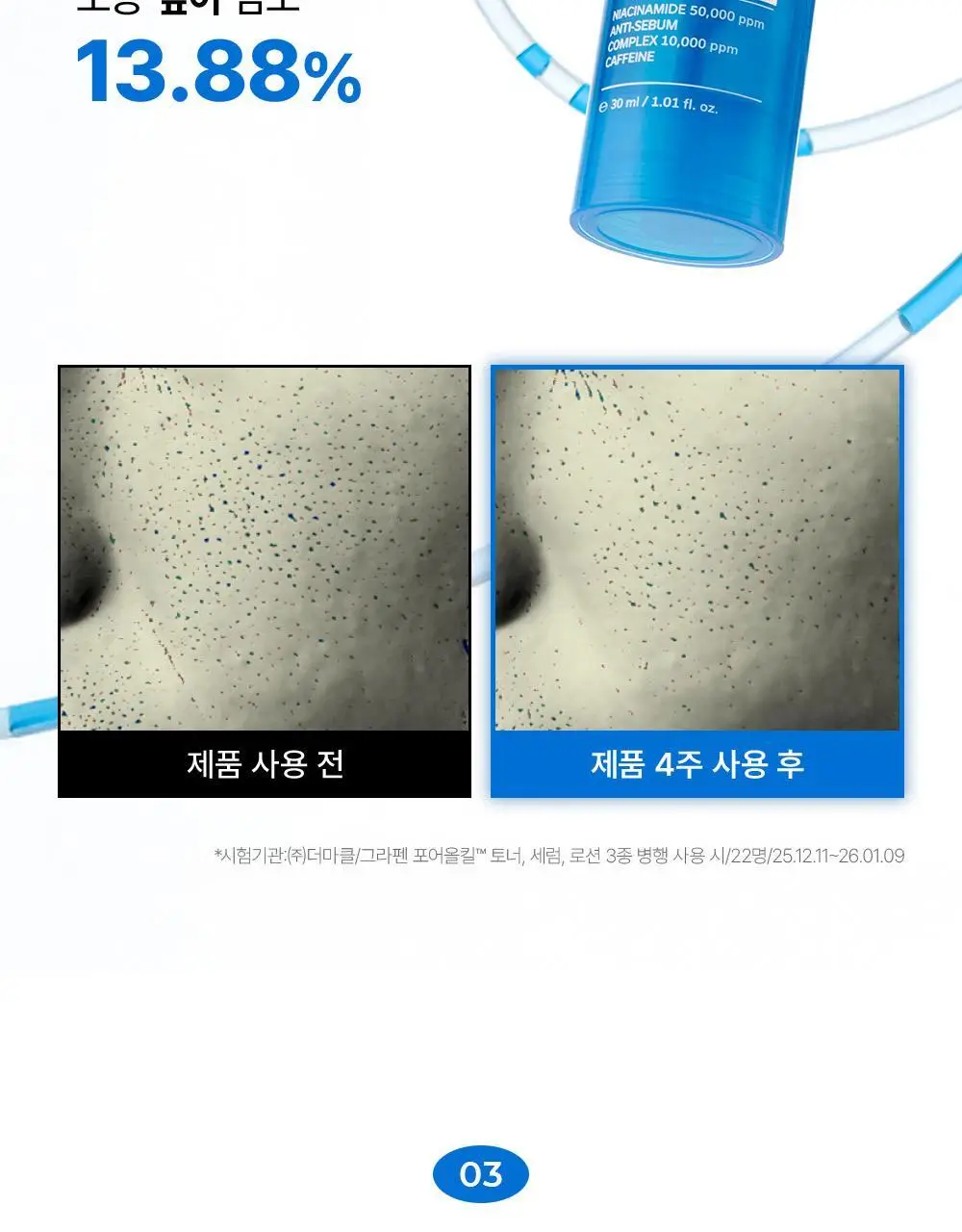 [피지/모공케어] 그라펜 포어올킬 타이트닝 세럼 30ml 상세페이지 12